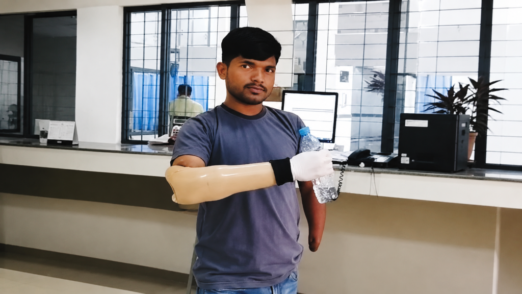 Myoelectric Hand